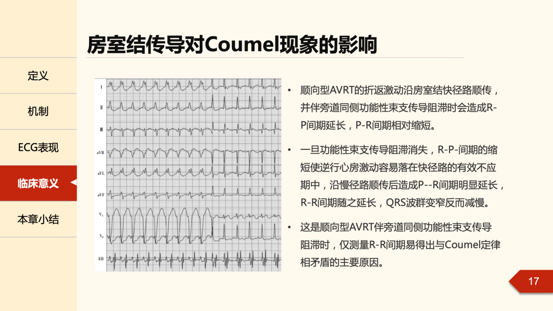 什么是心律失常中的Coumel现象？