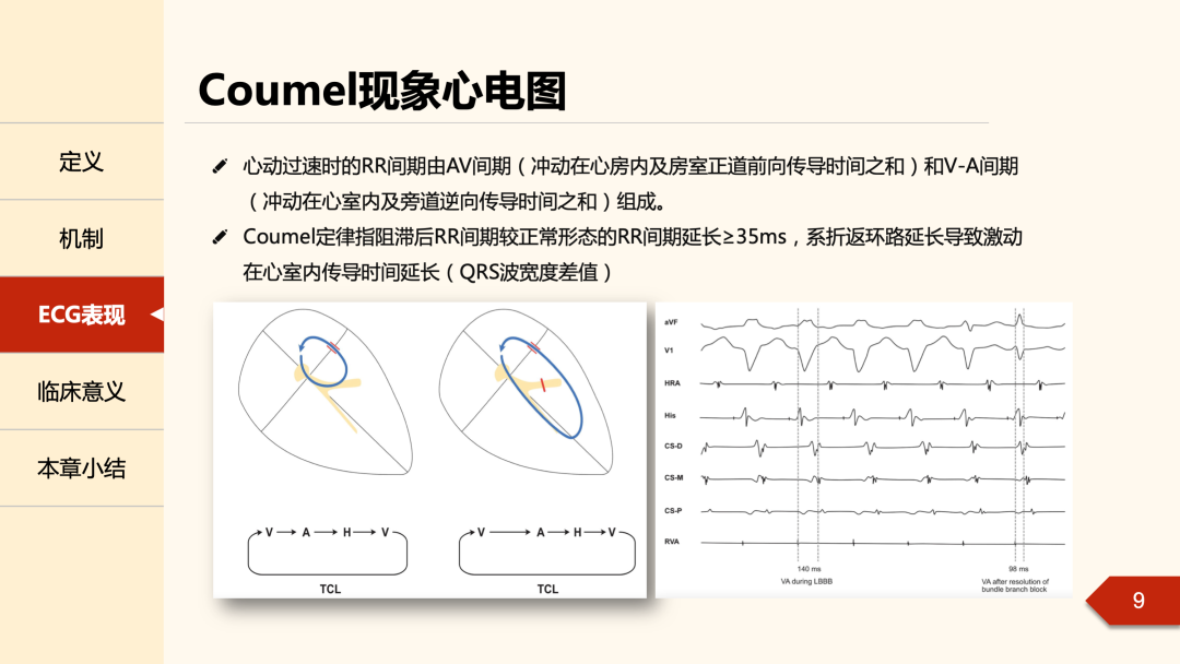 什么是心律失常中的Coumel现象？