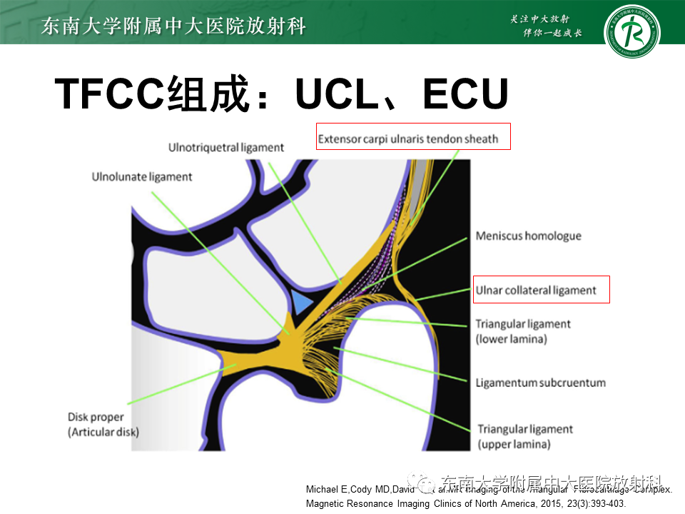 腕关节三角纤维软骨复合体（TFCC）解剖及创伤性损伤的影像表现