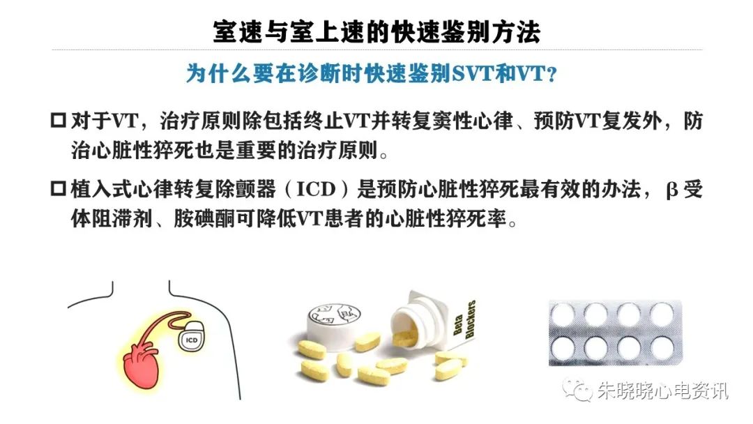 一看就会！室速与室上速的快速鉴别方法