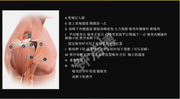 肩关节脱位“新认识”