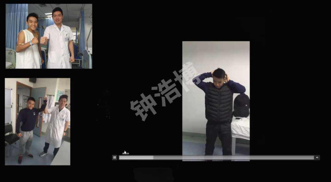 肩关节脱位“新认识”