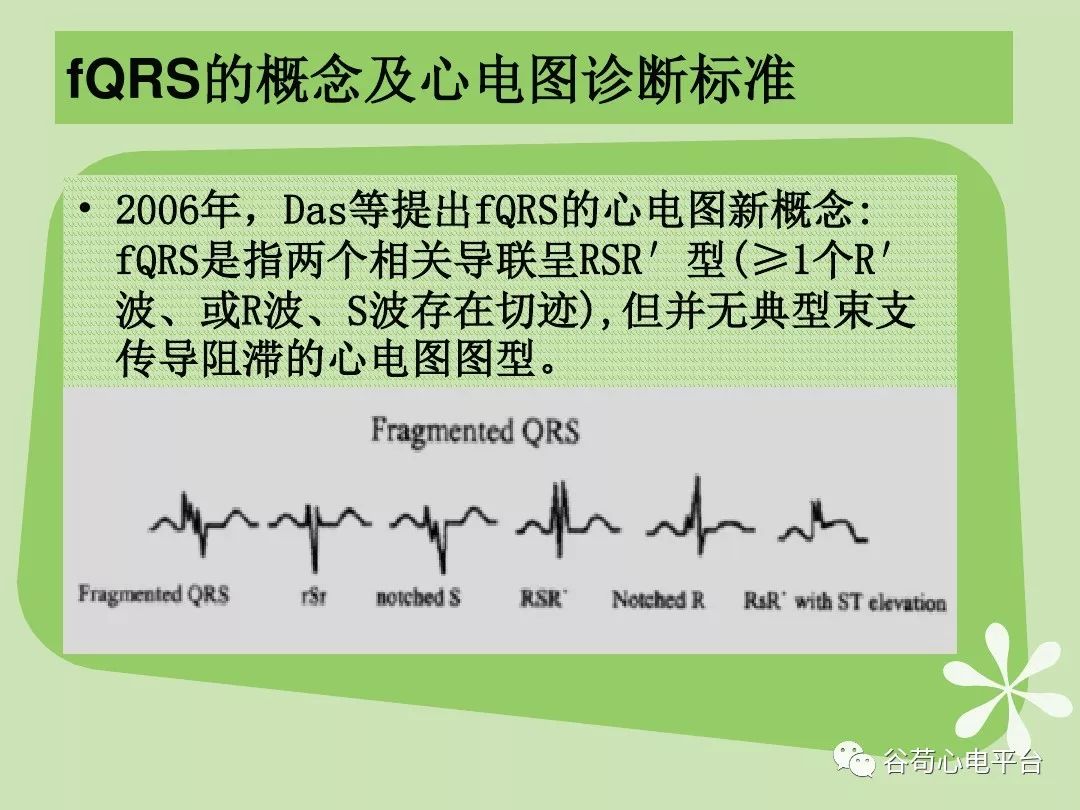 一个少见的心电图诊断名称：碎裂性QRS波