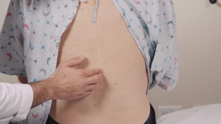 一文了解腰痛常用体格检查