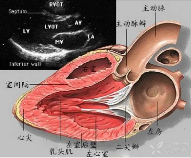 心脏超声各种平面解剖图，太震撼了！！