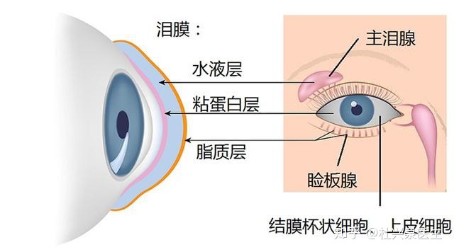 干眼症诊断与治疗之我见--干眼症详解