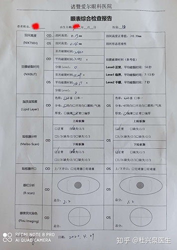 干眼症诊断与治疗之我见--干眼症详解