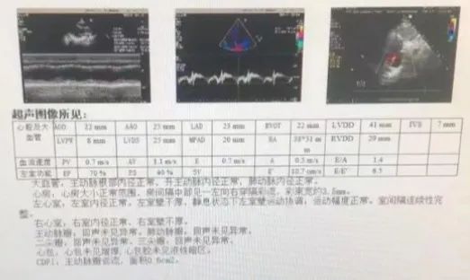 卵圆孔未闭和小房缺是咋回事？