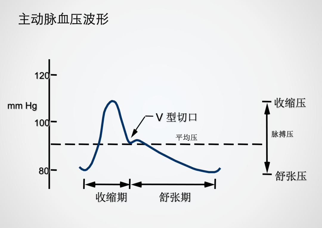 主动脉内球囊反搏操作规范