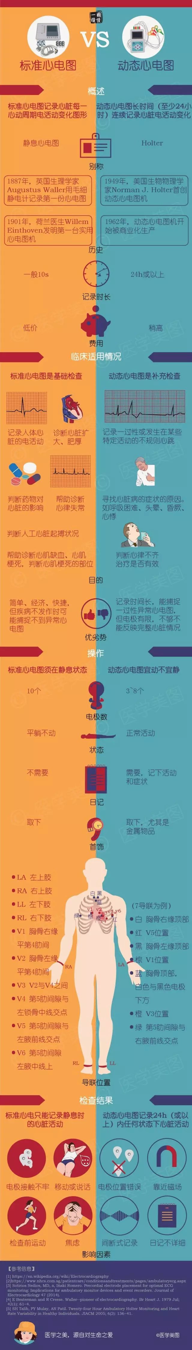 一图读懂标准心电图