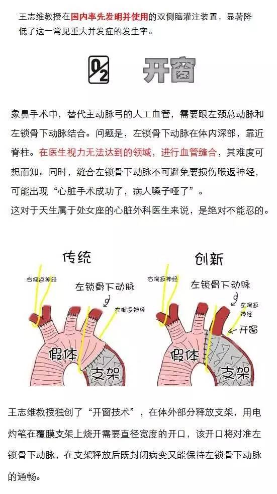 图解主动脉夹层，一看就懂了！