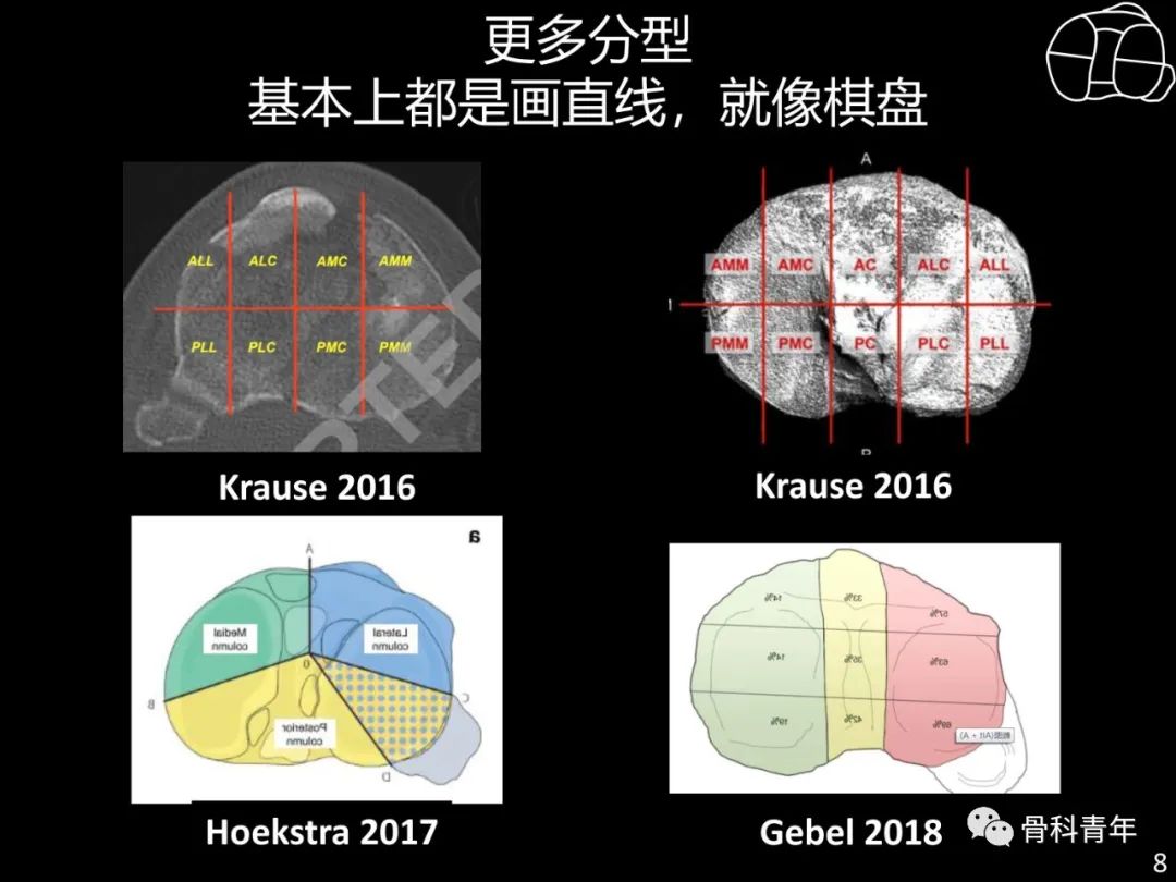 胫骨平台骨折“四柱九区分型”理论介绍