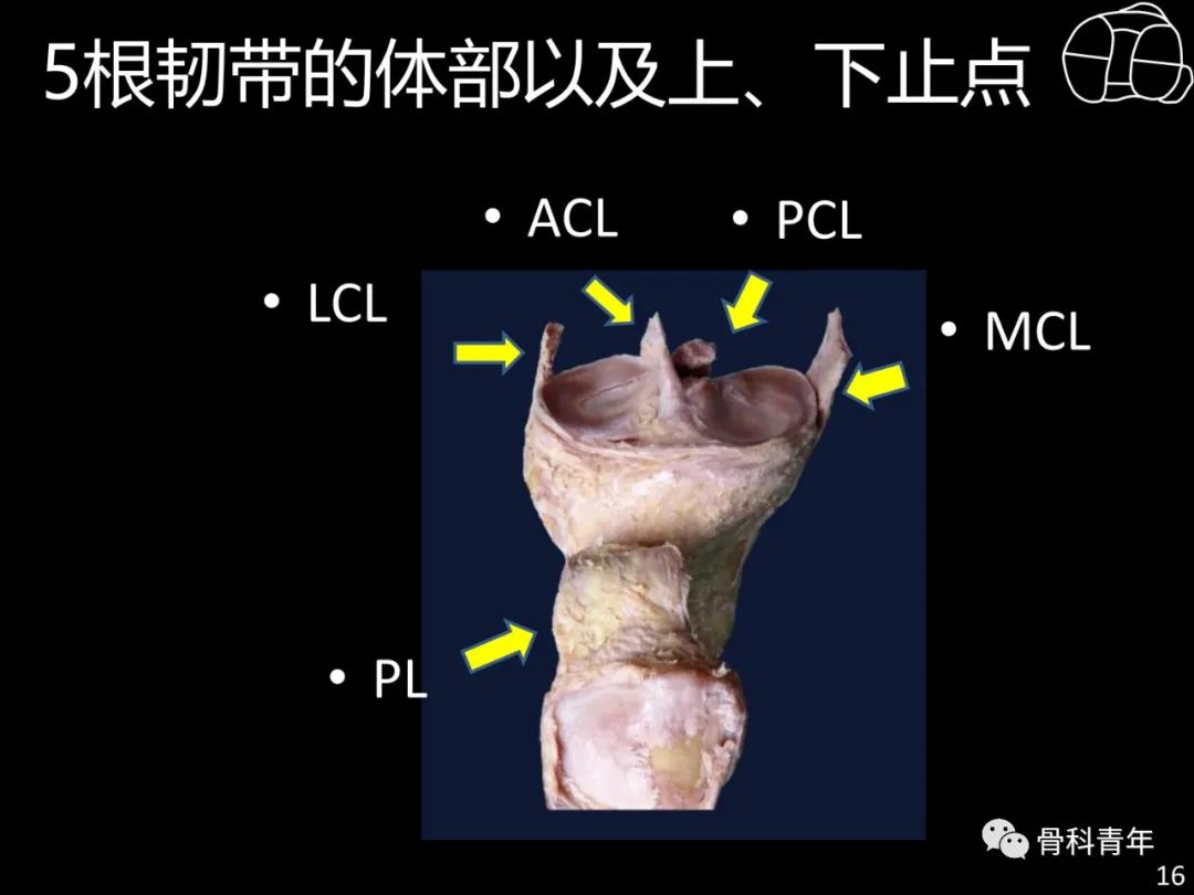 胫骨平台骨折“四柱九区分型”理论介绍