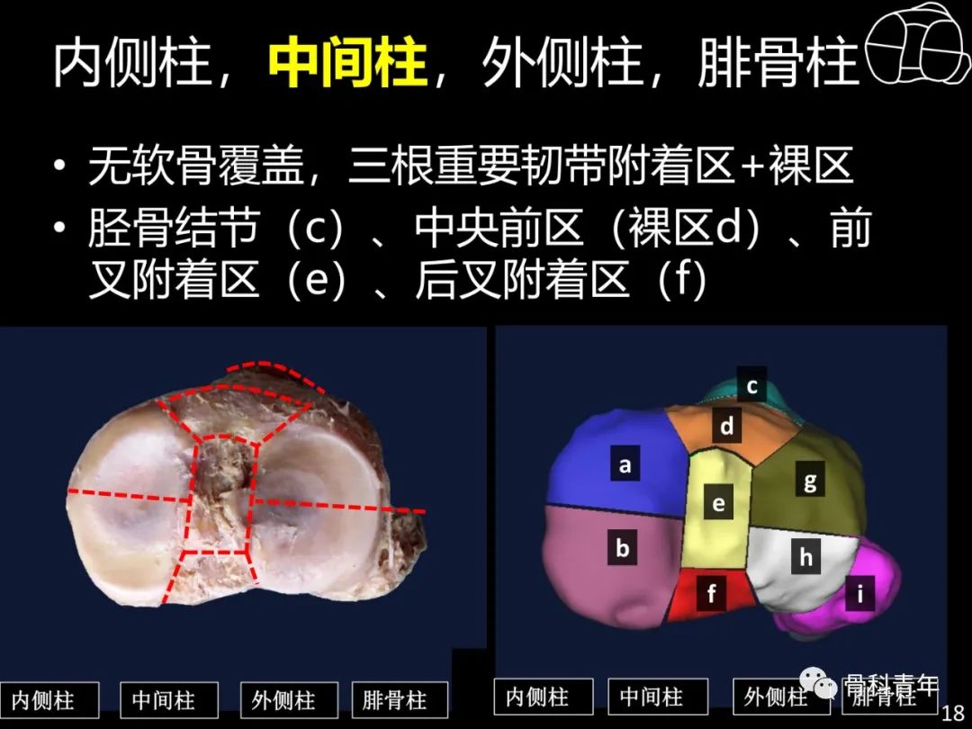 胫骨平台骨折“四柱九区分型”理论介绍