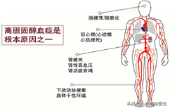 关于血脂的那些事儿……