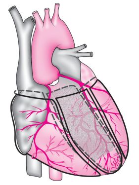心肌梗死的心电图诊断标准、定位及演变