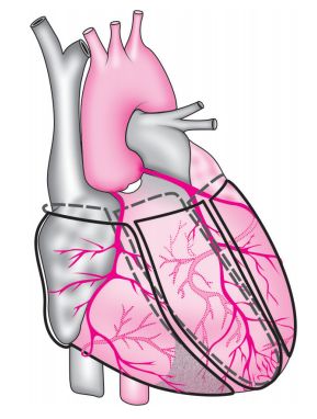 心肌梗死的心电图诊断标准、定位及演变