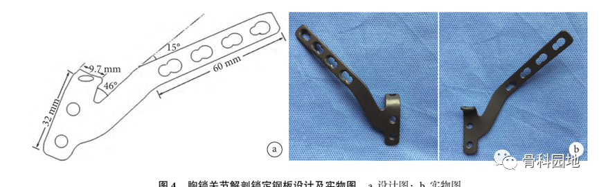 一文了解胸锁关节脱位固定技术