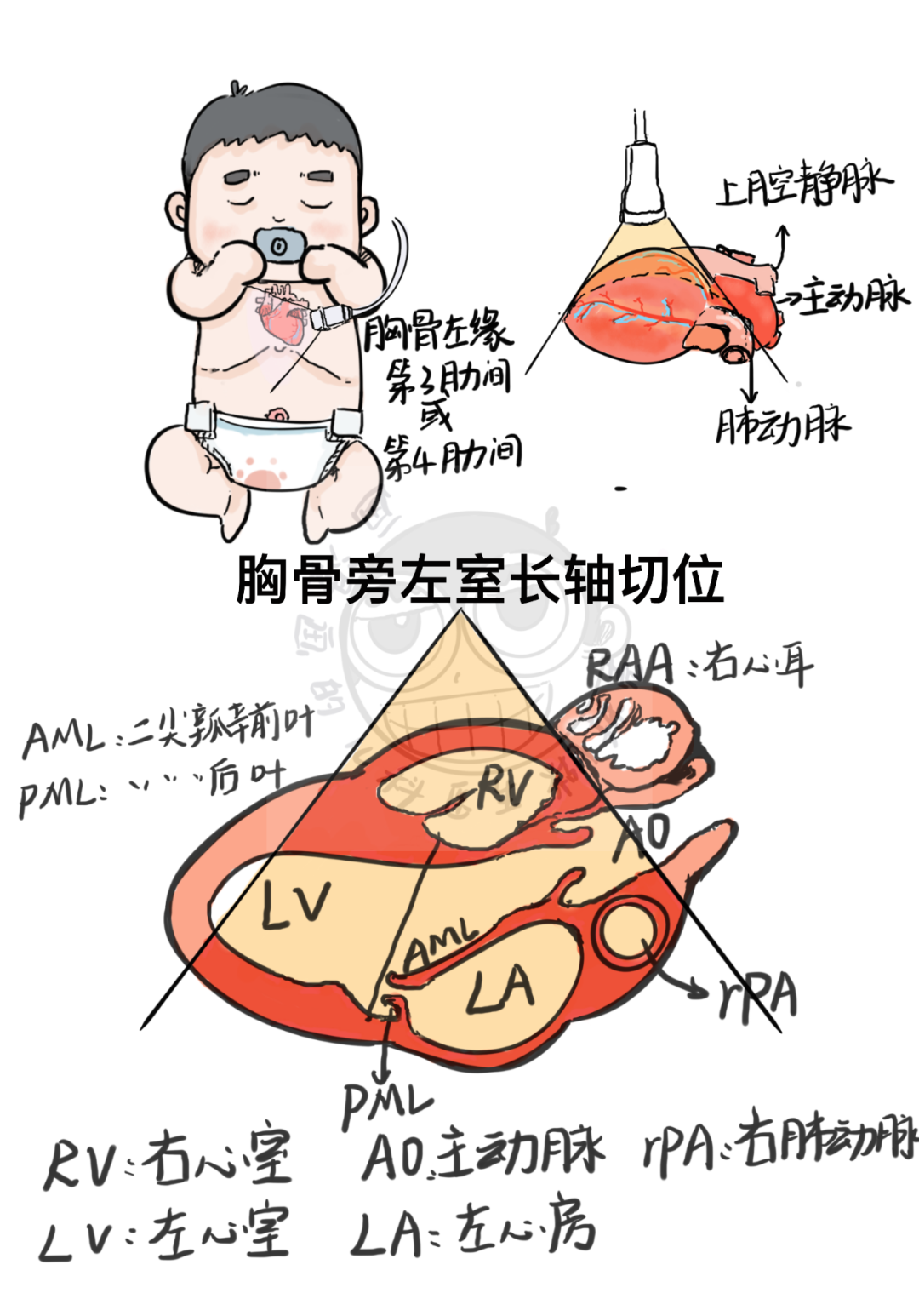 这该死的艺术细菌——心脏超声断层解剖临摹