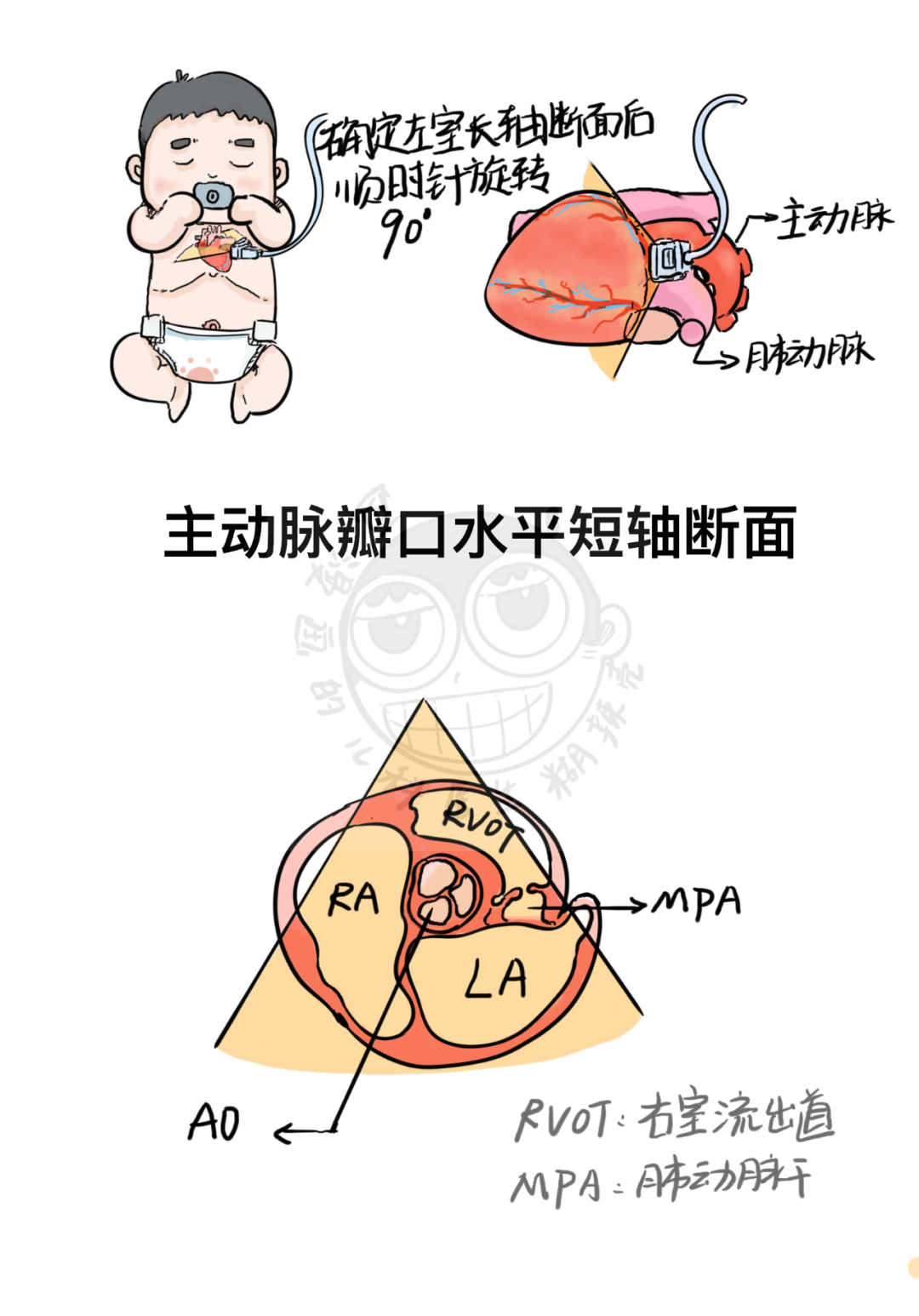 这该死的艺术细菌——心脏超声断层解剖临摹