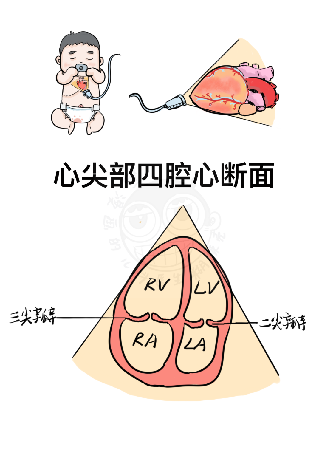 这该死的艺术细菌——心脏超声断层解剖临摹