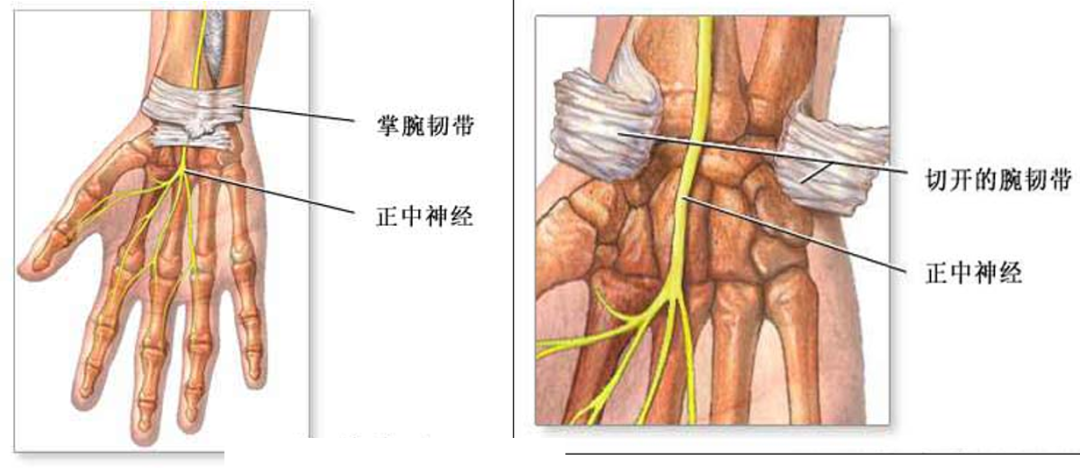 腕管综合征相关的解剖、病因、诊断和治疗