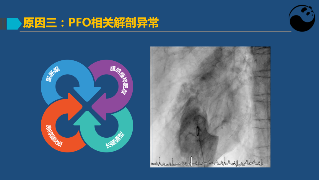 PFO封堵术后残余分流的诊断及处理