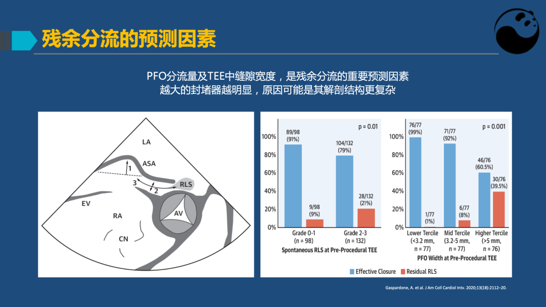 PFO封堵术后残余分流的诊断及处理