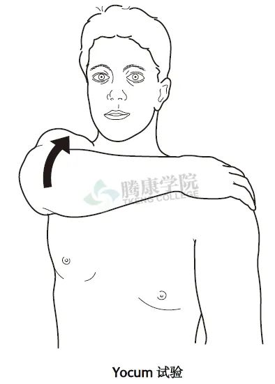 【汇总】肩关节的多项特殊检查