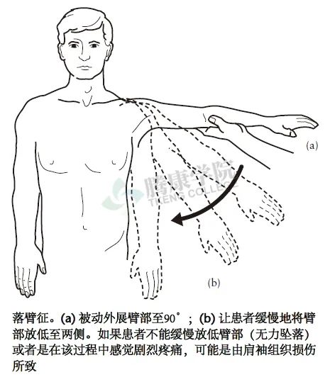 【汇总】肩关节的多项特殊检查