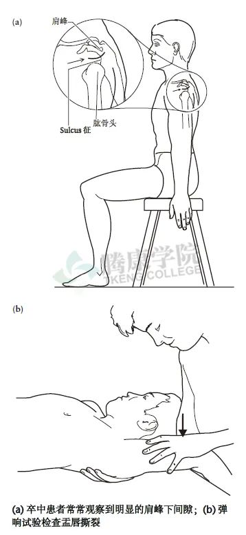 【汇总】肩关节的多项特殊检查