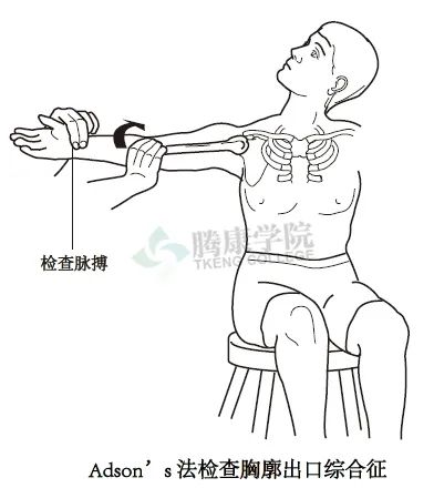 【汇总】肩关节的多项特殊检查