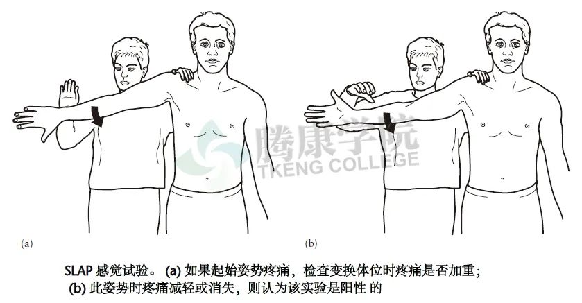 【汇总】肩关节的多项特殊检查