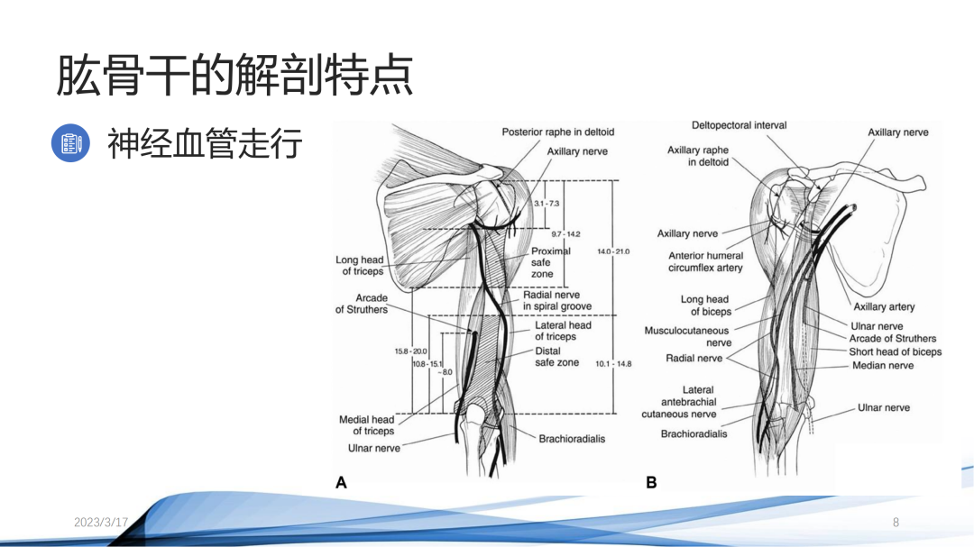 肱骨干骨折：开放复位内固定与髓内钉固定