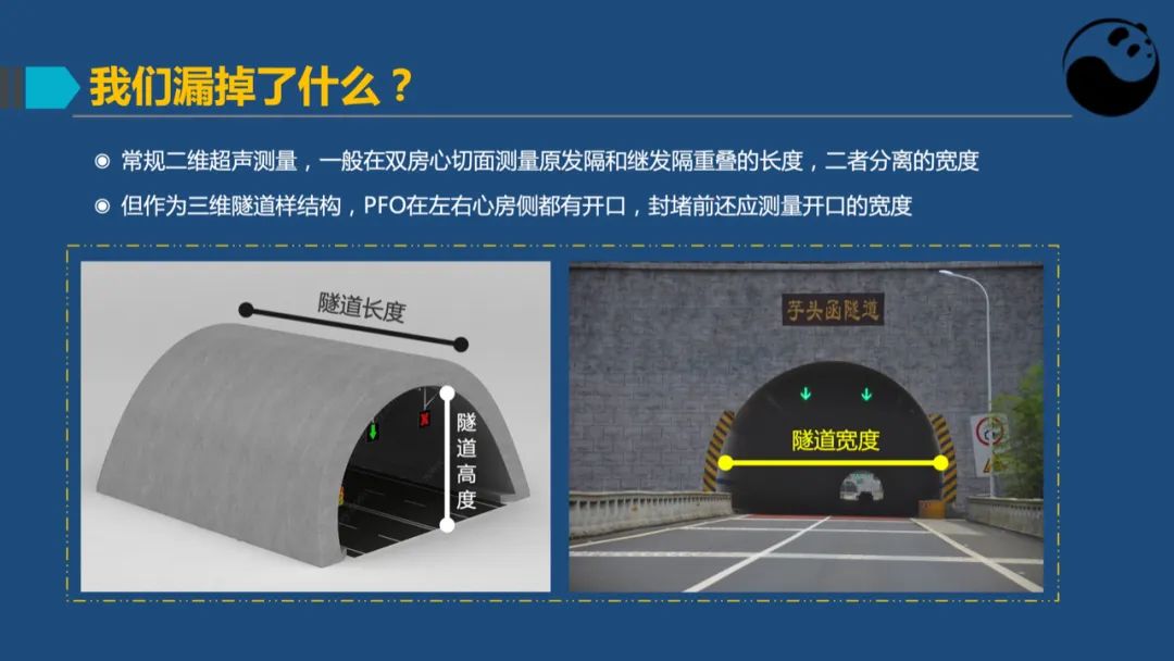 卵圆孔未闭（PFO）形态学测量思考