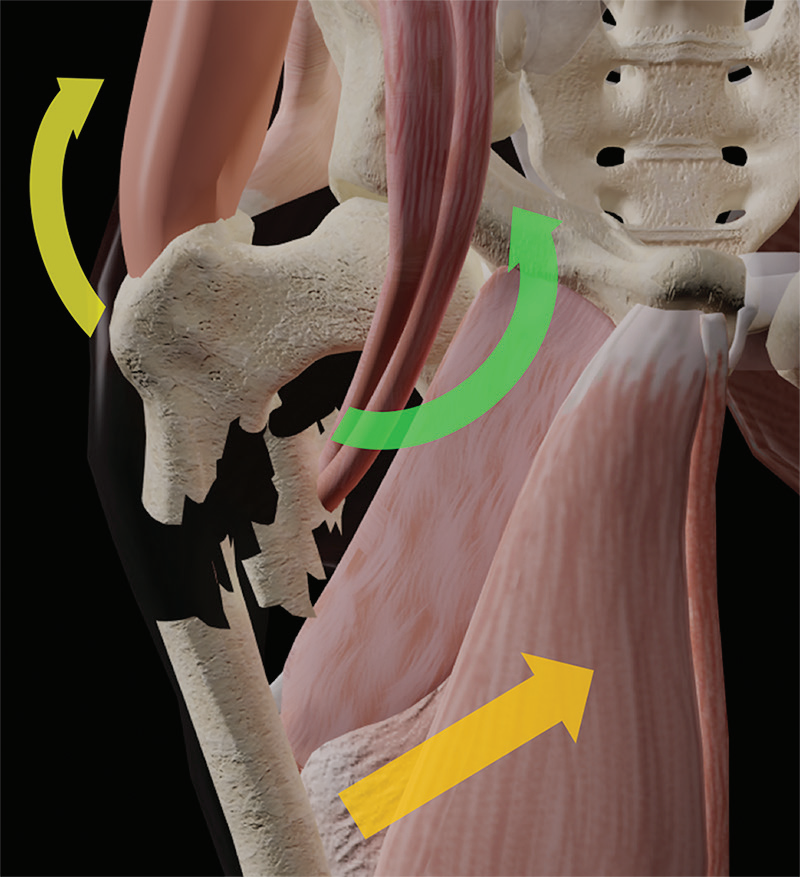 股骨近端骨折：每一个骨科医生都应该知道的要点