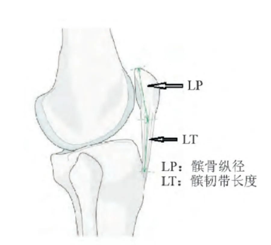 髌腱断裂的诊治