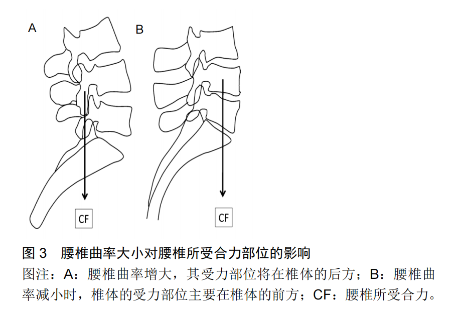髋-腰综合征与脊柱骨盆矢状位生物力学关系