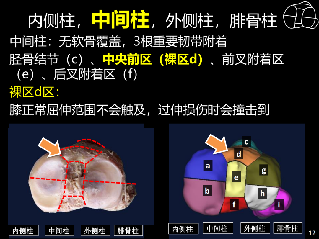 过伸型胫骨平台骨折