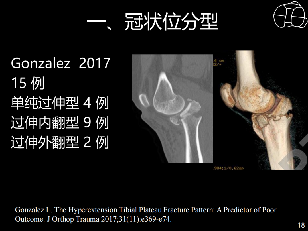 过伸型胫骨平台骨折