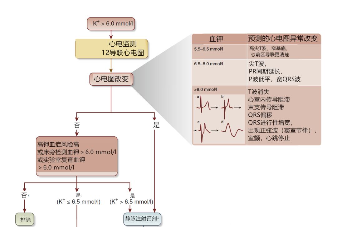 关于高钾血症，知识点都在这里了！