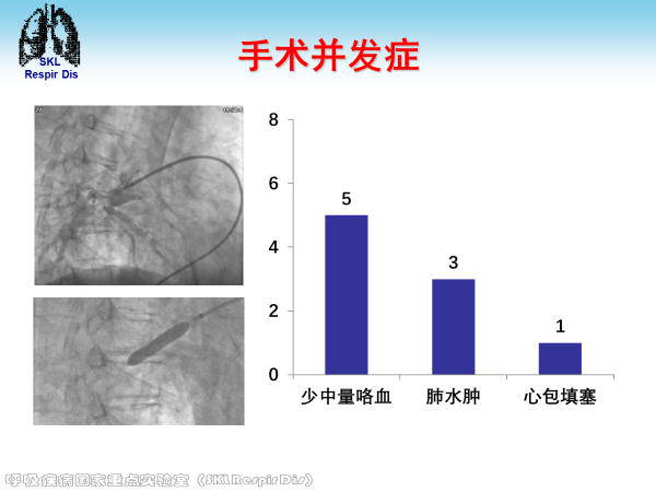 慢性血栓栓塞性肺动脉高压的诊治