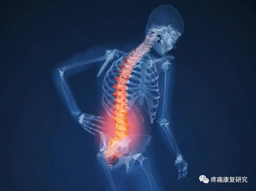 窦椎神经导致腰痛的相关解剖、机制、症状、诊断和治疗
