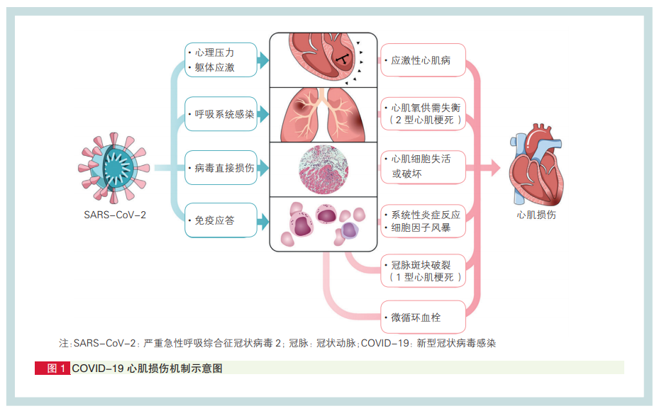 新冠相关心肌损伤，用磁共振评估最可靠！中国共识
