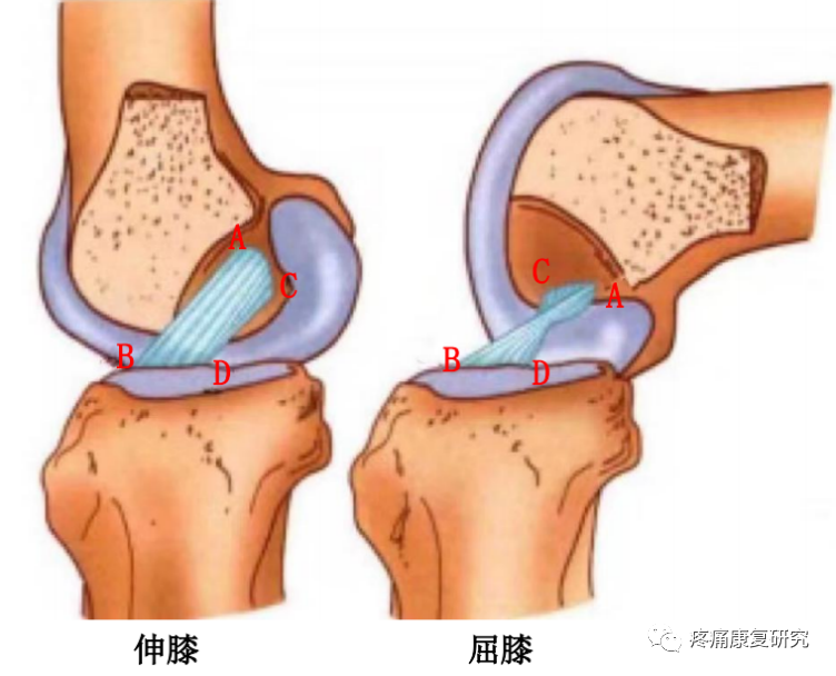 前交叉韧带损伤的相关解剖、分型、病因、症状、诊断和治疗