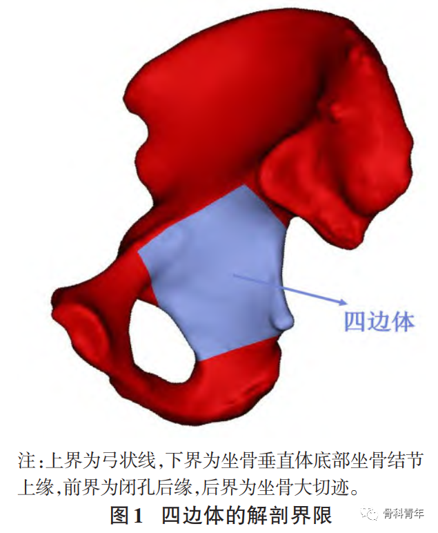 髋臼四边体骨折临床诊疗指南（2023版）