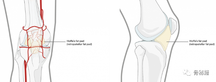 膝关节置换术后的髌骨骨折