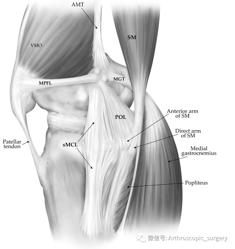【手术技术】如何充分的暴露膝关节内侧间室？