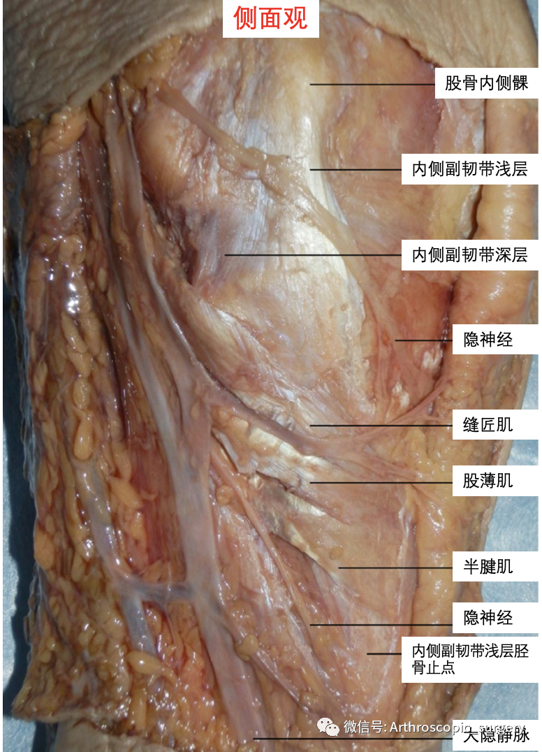 【手术技术】如何充分的暴露膝关节内侧间室？