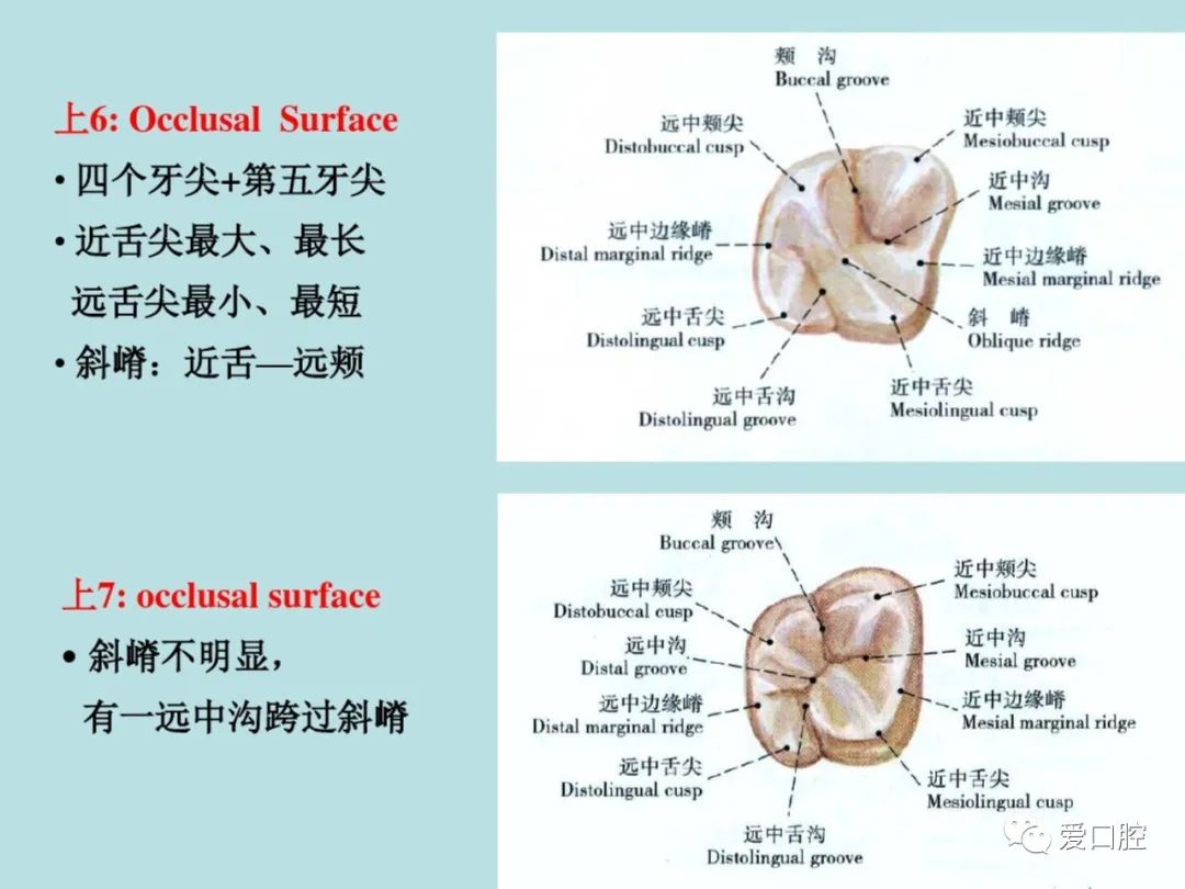 盘点磨牙开髓的方法